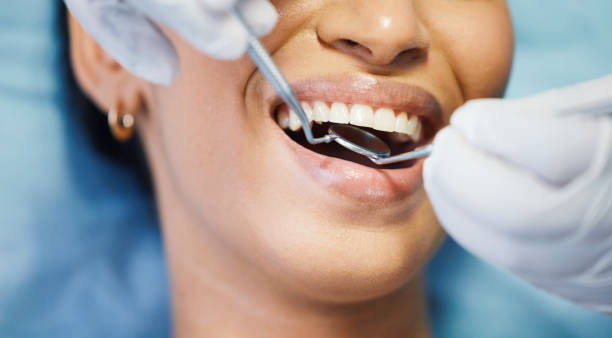 Best Knocked-Out Tooth (Avulsed Tooth) Treatment in Wakefield, KS